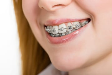Orthodontics | McLean VA