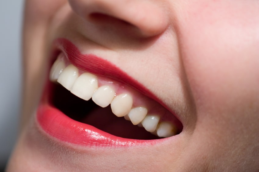 Teeth Whitening | Mclean VA