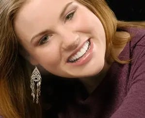 Tooth Colored Fillings in Arlington VA
