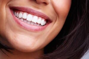 Close up of woman's perfect teeth smiling after a smile makeover in McLean, VA